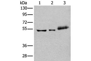 Western blot analysis of Hela cell Mouse kidney tissue and Human colorectal cancer tissue lysates using YY2 Polyclonal Antibody at dilution of 1:800 (YY2 抗体)