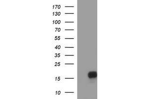 Image no. 1 for anti-SIVA1, Apoptosis-Inducing Factor (SIVA1) antibody (ABIN1500939) (SIVA1 抗体)