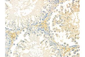 ABIN6263535 and ABIN6276581 at 1/100 staining Rat testis tissue by IHC-P. (NCF2 抗体  (N-Term))