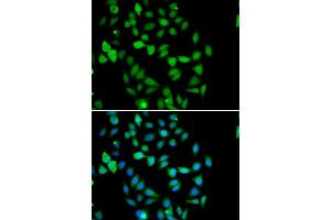 Immunofluorescence analysis of U20S cell using STAMBP antibody. (STAMBP 抗体)
