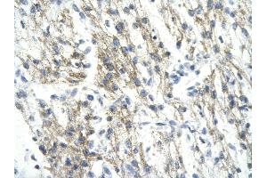 Rabbit Anti-RUVBL1 antibody   Paraffin Embedded Tissue: Human Heart cell Cellular Data: cardiac cell of renal tubule Antibody Concentration: 4. (RUVBL1 抗体  (N-Term))