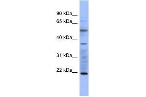 MYL3 antibody used at 1 ug/ml to detect target protein. (MYL3/CMLC1 抗体  (N-Term))