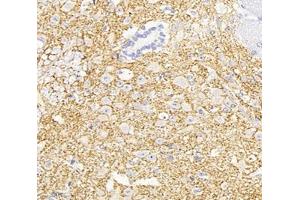Immunohistochemistry analysis of paraffin-embedded mouse spinal cord using,KCC2 (ABIN7075650) at dilution of 1: 1800 (KCC2 抗体)