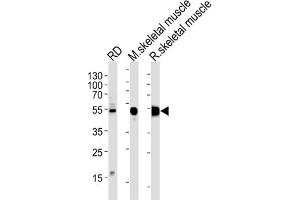 Western Blotting (WB) image for anti-Enolase 3 (Beta, Muscle) (ENO3) antibody (ABIN3001691) (ENO3 抗体)