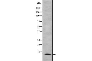 Western blot analysis of MK1I1 expression in HEK293 cells ,The lane on the left is treated with the antigen-specific peptide. (MAPKSP1 抗体  (Internal Region))