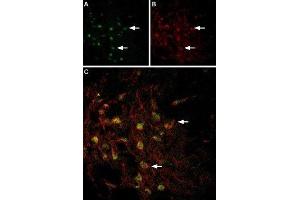 Multiplex staining of VMAT2 and TRPC3 in rat brain - Immunohistochemical staining of perfusion-fixed frozen rat substantia nigra sections using Anti-VMAT2-ATTO Fluor-488 Antibody (ABIN7043689), (1:60) and Anti-TRPC3-ATTO Fluor-594 Antibody (ABIN7043819), (1:60).