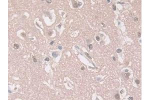 Detection of GUCY1b3 in Human Cerebrum Tissue using Polyclonal Antibody to Guanylate Cyclase 1 Beta 3 (GUCY1b3) (GUCY1B3 抗体  (AA 408-619))