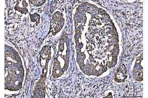 IHC analysis of CPT1A using anti-CPT1A antibody (ABIN7599853).