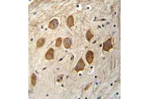 Immunohistochemistry (Paraffin-embedded Sections) (IHC (p)) image for anti-Host Cell Factor C1 Regulator 1 (XPO1 Dependent) (HCFC1R1) (AA 1-30), (N-Term) antibody (ABIN952687)