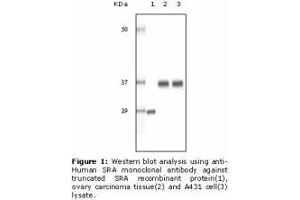 Image no. 2 for anti-Steroid Receptor RNA Activator 1 (SRA1) antibody (ABIN232101) (SRA1 抗体)
