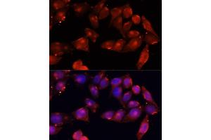Immunofluorescence analysis of HeLa cells using B antibody (ABIN7265414) at dilution of 1:100 (40x lens). (ACVR2B 抗体  (AA 50-150))