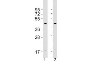 Western blot testing of human 1) HeLa and 2) Jurkat cell lysate with Atrogin 1 antibody at 1:2000.