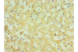 Immunohistochemistry of paraffin-embedded human liver tissue using ABIN7145505 at dilution of 1:100 (Glucuronidase beta 抗体  (AA 382-651))