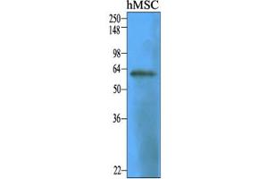 Western Blotting (WB) image for anti-5'-Nucleotidase, Ecto (CD73) (NT5E) antibody (ABIN361024) (CD73 抗体)