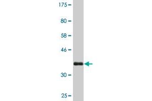 Western Blot detection against Immunogen (36. (FZD4 抗体  (AA 107-206))