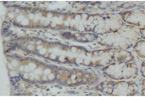 ABIN6274989 at 1/100 staining human colon carcinoma tissue sections by IHC-P. (CEP55 抗体  (C-Term))