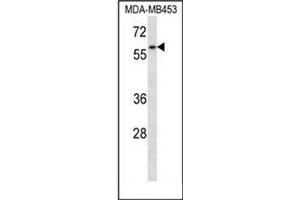 Western blot analysis of XRCC9 / FANCG Antibody (C-term) in MDA-MB453 cell line lysates (35ug/lane). (FANCG 抗体  (C-Term))