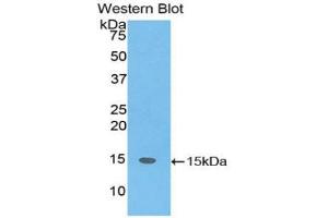 Western blot analysis of the recombinant protein. (SH2D1A 抗体  (AA 18-115))