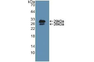 Western blot analysis of recombinant Mouse NUP85. (NUP85 抗体  (AA 418-653))