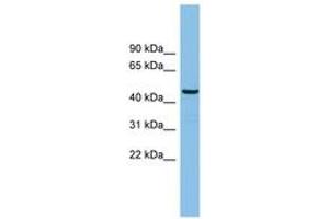 Image no. 1 for anti-HCLS1 Binding Protein 3 (HS1BP3) (AA 71-120) antibody (ABIN6745187) (HS1BP3 抗体  (AA 71-120))