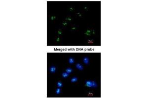 ICC/IF Image Immunofluorescence analysis of paraformaldehyde-fixed A549, using RASSF2, antibody at 1:200 dilution. (RASSF2 抗体  (Center))