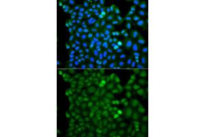Immunofluorescence analysis of A549 cell using RNF125 antibody. (RNF125 抗体)