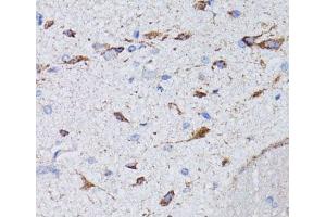 Immunohistochemistry of paraffin-embedded Rat brain using AVP Polyclonal Antibody at dilution of 1:100 (40x lens). (Vasopressin 抗体)