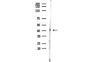 anti-Heterogeneous Nuclear Ribonucleoprotein C (C1/C2) (HNRNPC) (pSer260) antibody