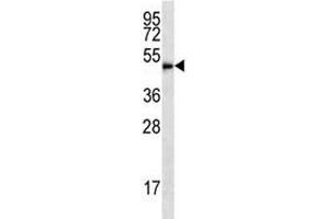 HDAC3 antibody western blot analysis in HL-60 lysate (HDAC3 抗体  (AA 383-412))
