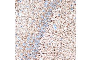 Immunohistochemistry of paraffin-embedded rat brain using Alpha Internexin Rabbit mAb (ABIN7268012) at dilution of 1:100 (40x lens). (INA 抗体)