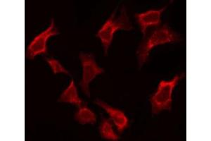 ABIN6274145 staining Hela by IF/ICC. (BAF53A 抗体  (Internal Region))