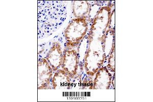 DNMT3A Antibody (Center R478WMutant) immunohistochemistry analysis in formalin fixed and paraffin embedded human kidney tissue followed by peroxidase conjugation of the secondary antibody and DAB staining. (DNMT3A 抗体  (AA 457-486))
