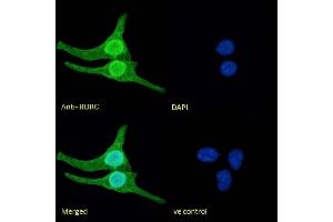 (ABIN625825) Immunofluorescence analysis of paraformaldehyde fixed U2OS cells, permeabilized with 0. (RORC 抗体  (AA 200-212))