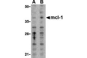 Western Blotting (WB) image for anti-Induced Myeloid Leukemia Cell Differentiation Protein Mcl-1 (MCL1) (N-Term) antibody (ABIN1031455) (MCL-1 抗体  (N-Term))