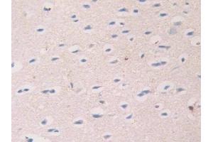 Detection of MAOA in Mouse Cerebrum Tissue using Polyclonal Antibody to Monoamine Oxidase A (MAOA)