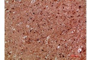 Immunohistochemistry (IHC) image for anti-Inhibitor of kappa Light Polypeptide Gene Enhancer in B-Cells, Kinase gamma (IKBKG) (AA 60-120) antibody (ABIN7189515)