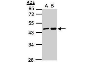 WB Image Sample(30 ug whole cell lysate) A:A431, B:H1299 10% SDS PAGE antibody diluted at 1:5000 (MAGEA11 抗体  (N-Term))