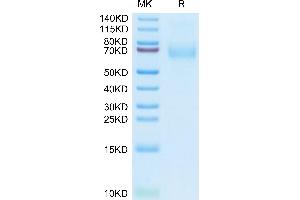 Macrophage Scavenger Receptor 1 Protein (MSR1) (AA 77-451) (His tag)