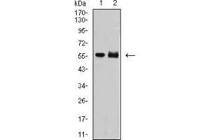 Western Blotting (WB) image for anti-Deoxynucleotidyltransferase, terminal (DNTT) (AA 52-192) antibody (ABIN5542550)