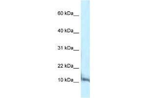 WB Suggested Anti-Pcbd1 Antibody Titration: 1. (PCBD1 抗体  (C-Term))