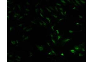 Immunofluorescence staining of Hela cells with ABIN7142045 at 1:100, counter-stained with DAPI. (Phospholipase C beta 2 抗体  (AA 1031-1185))