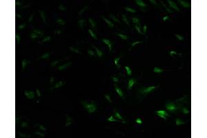 Immunofluorescence staining of Hela cells with ABIN7142045 at 1:100, counter-stained with DAPI. (Phospholipase C beta 2 抗体  (AA 1031-1185))