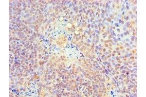 Immunohistochemistry of paraffin-embedded human tonsil tissue using ABIN7157727 at dilution of 1:100 (KLF4 抗体  (AA 30-230))