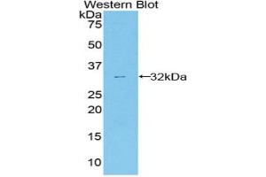 Western blot analysis of the recombinant protein. (ANXA6 抗体  (AA 251-504))