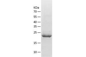 Lin-7 Homolog A (LIN7A) (AA 1-233) protein (His tag)