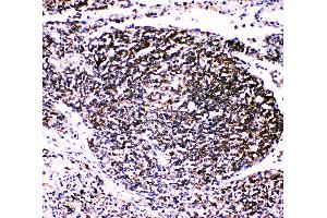Anti-TRAF4 antibody, IHC(P) IHC(P): Human Lung Cancer Tissue (TRAF4 抗体  (C-Term))