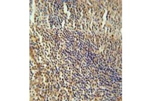 Immunohistochemistry analysis in formalin fixed and paraffin embedded human tonsil tissue reacted with MEF2A Antibody (Center) followed which was peroxidase conjugated to the secondary antibody and followed by DAB staining. (MEF2A 抗体  (Middle Region))