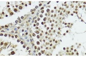 Immunohistochemistry of paraffin-embedded Rat testis using Phospho-Histone H3(T11) Polyclonal Antibody at dilution of 1:100 (40x lens). (Histone 3 抗体  (pThr11))
