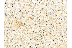 ABIN6261435 and ABIN6276463 at 1/100 staining Rat heart tissue by IHC-P. (Endothelin 3 抗体  (C-Term))
