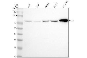 Western blot analysis of GCLC using anti-GCLC antibody (ABIN7604947).